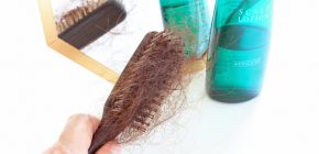 【博士の育毛診療日誌】髪の本数が減少する休止期脱毛症