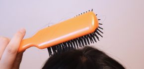 【専門医の育毛レッスン】女性の薄毛・抜け毛の基礎知識 なぜ脱毛は起こる? 【専門医の育毛レッスン】女性の薄毛・抜け毛の基礎知識 なぜ脱毛は起こる?