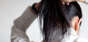 【博士の育毛診療日誌】ヘアスタイルが招いた脱毛症