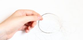 【育毛の基礎知識】正常な抜け毛と女性型脱毛症（薄毛）の違いって？