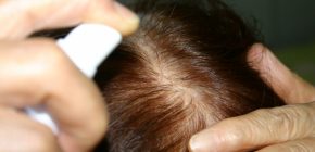 育毛剤の働きについて学びましょう